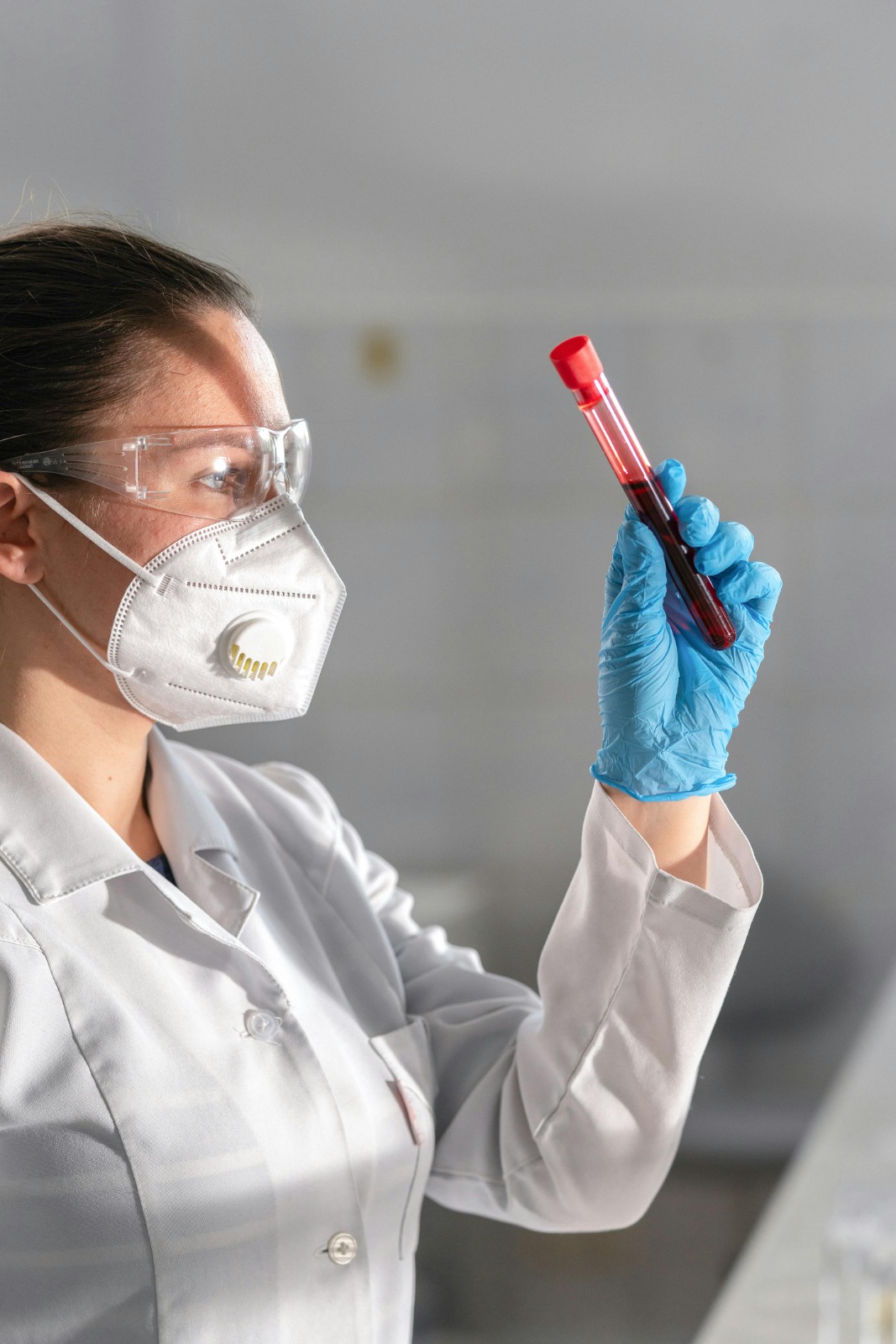 Other Infectious Disease